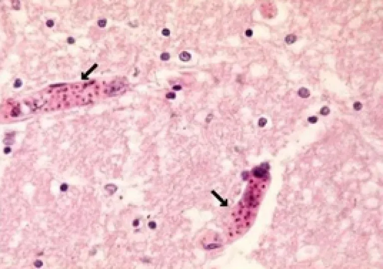 Plasmodium falciparum maliarija Nuotrauka Nr. 3