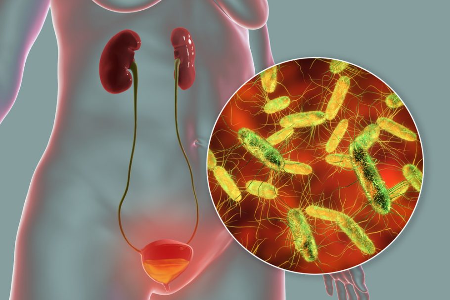 Escherichia coli infekcija Nuotrauka Nr. 2